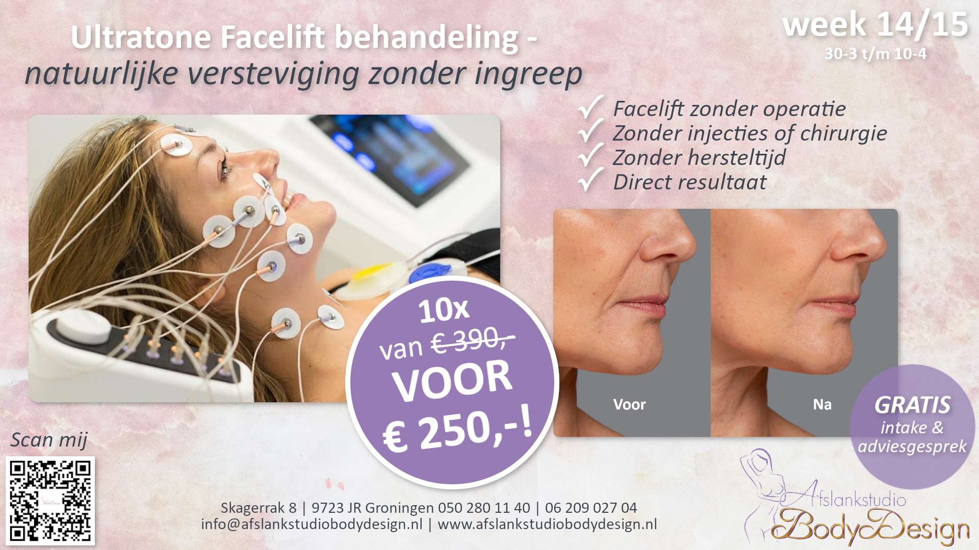 Ultratone Facelift week deal 14-15 - Afslankstudio Body Design Groningen